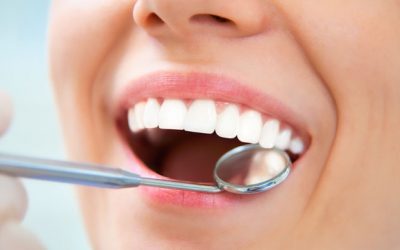 6 affordable tooth replacement options for missing teeth